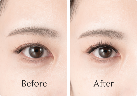 1秒まつエク装着BEFORE AFTER